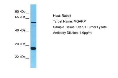 Western Blot: OSAP Antibody [NBP2-85426]