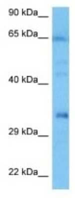 Western Blot: OSAP Antibody [NBP3-10151]