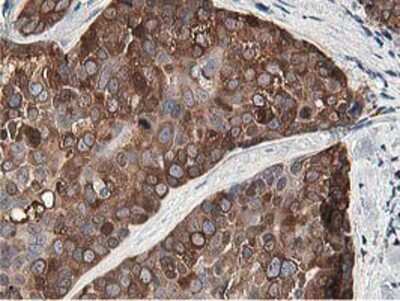 Immunohistochemistry-Paraffin: OSBP1 Antibody (OTI1F2) [NBP2-00935]
