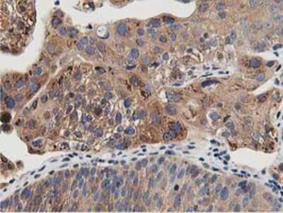 Immunohistochemistry-Paraffin: OSBP1 Antibody (OTI1F2) [NBP2-00935]