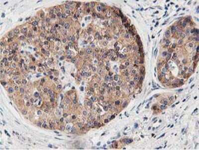 Immunohistochemistry-Paraffin: OSBP1 Antibody (OTI1F2) [NBP2-00935]
