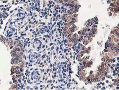 Immunohistochemistry-Paraffin: OSBP1 Antibody (OTI1F2) [NBP2-00935]