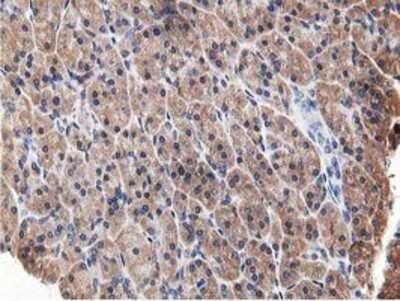 Immunohistochemistry-Paraffin: OSBP1 Antibody (OTI1F2) [NBP2-00935]