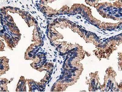 Immunohistochemistry-Paraffin: OSBP1 Antibody (OTI1F2) [NBP2-00935]