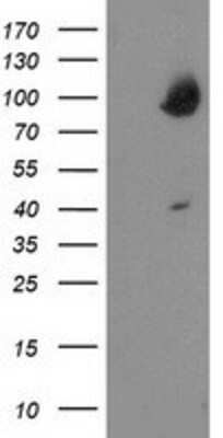 Western Blot: OSBP1 Antibody (OTI1F2) [NBP2-00935]