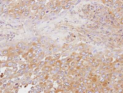 Immunohistochemistry-Paraffin: OSBP1 Antibody [NBP2-15057]