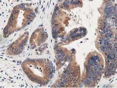 Immunohistochemistry: OSBP1 Antibody (OTI1F2) - Azide and BSA Free [NBP2-73152]