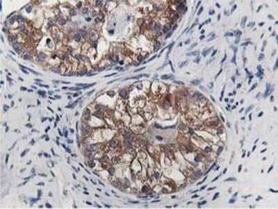 Immunohistochemistry: OSBP1 Antibody (OTI1F2) - Azide and BSA Free [NBP2-73152]