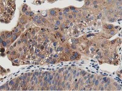 Immunohistochemistry: OSBP1 Antibody (OTI1F2) - Azide and BSA Free [NBP2-73152]