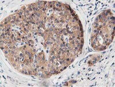Immunohistochemistry: OSBP1 Antibody (OTI1F2) - Azide and BSA Free [NBP2-73152]