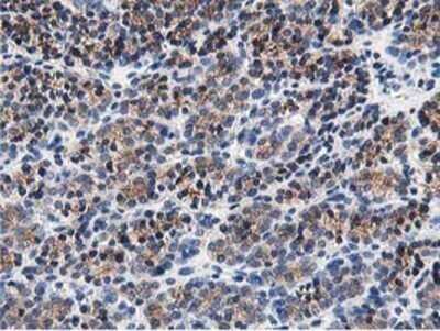 Immunohistochemistry: OSBP1 Antibody (OTI1F2) - Azide and BSA Free [NBP2-73152]
