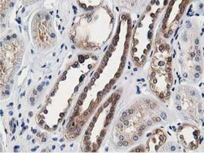 Immunohistochemistry: OSBP1 Antibody (OTI1F2) - Azide and BSA Free [NBP2-73152]