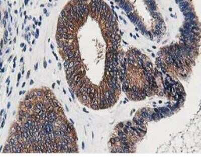 Immunohistochemistry: OSBP1 Antibody (OTI1F2) - Azide and BSA Free [NBP2-73152]