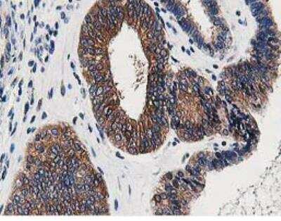 Immunohistochemistry-Paraffin: OSBP1 Antibody (OTI1F2) [NBP2-00935]