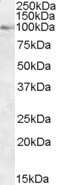 Western Blot: OSBP1 Antibody [NB100-1329]