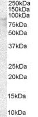 Western Blot: OSBP1 Antibody [NB100-1500]