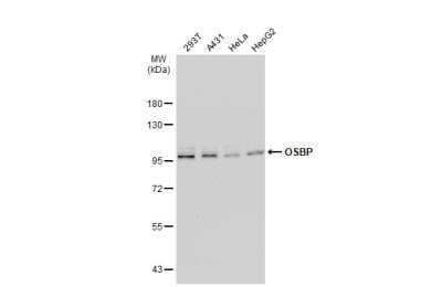 Western Blot: OSBP1 Antibody [NBP2-15056]