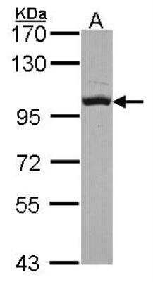 Western Blot: OSBP1 Antibody [NBP2-15057]