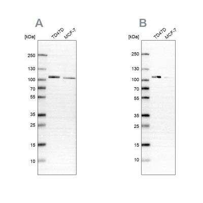 Western Blot: OSBP1 Antibody [NBP2-47343]