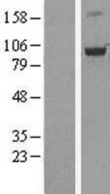 Western Blot: OSBP1 Overexpression Lysate [NBL1-13984]