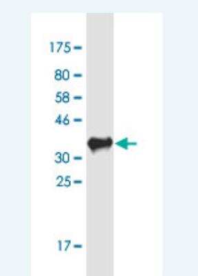 Western Blot: OSBP2 Antibody (2B4) [H00023762-M10-100ug]