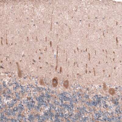 Immunohistochemistry-Paraffin: OSBP2 Antibody [NBP1-81388]