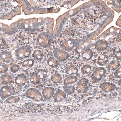 Immunohistochemistry-Paraffin: OSBP2 Antibody [NBP1-81388]