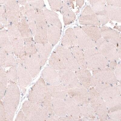 Immunohistochemistry-Paraffin: OSBP2 Antibody [NBP1-81388]