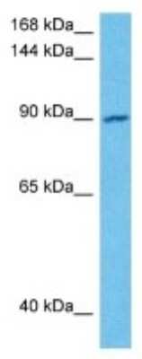 Western Blot: OSBP2 Antibody [NBP3-10047]