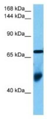 Western Blot: OSBP2 Antibody [NBP3-10082]