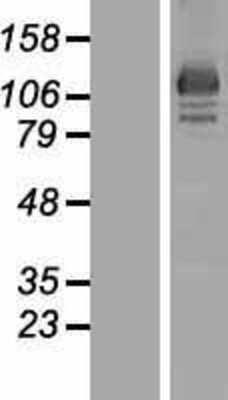 Western Blot: OSBP2 Overexpression Lysate [NBP2-06193]