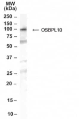 Western Blot: OSBPL10 Antibody [NB100-2448]