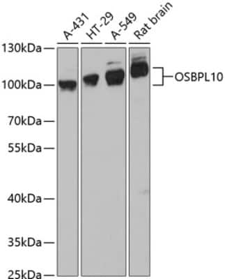 Western Blot: OSBPL10 AntibodyAzide and BSA Free [NBP2-93712]