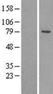 Western Blot: OSBPL10 Overexpression Lysate [NBL1-13985]