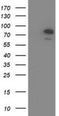 Western Blot: OSBPL11 Antibody (OTI6A6) [NBP2-03327]