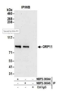 Immunoprecipitation: OSBPL11 Antibody [NBP2-36545]