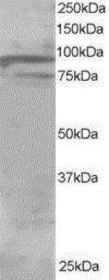 Western Blot: OSBPL11 Antibody [NB100-1337]