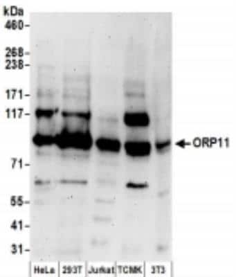 Western Blot: OSBPL11 Antibody [NBP2-36544]