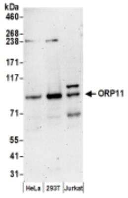 Western Blot: OSBPL11 Antibody [NBP2-36545]