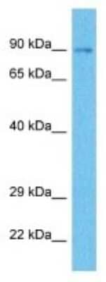 Western Blot: OSBPL11 Antibody [NBP3-10059]