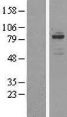 Western Blot: OSBPL11 Overexpression Lysate [NBL1-13986]