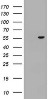 Western Blot: OSBPL2 Antibody (OTI2E6) [NBP2-45878]