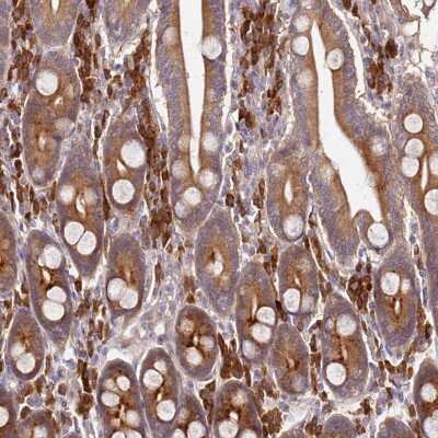 Immunohistochemistry-Paraffin: OSBPL2 Antibody [NBP1-92237]