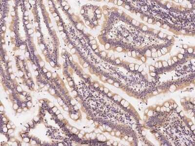 Immunohistochemistry-Paraffin: OSBPL2 Antibody [NBP2-97886]