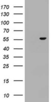 Western Blot: OSBPL2 Antibody (OTI2E6)Azide and BSA Free [NBP2-73161]