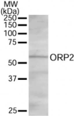 Western Blot: OSBPL2 Antibody [NB100-1332]