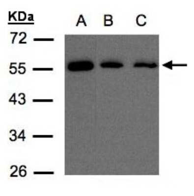 Western Blot: OSBPL2 Antibody [NBP1-31065]