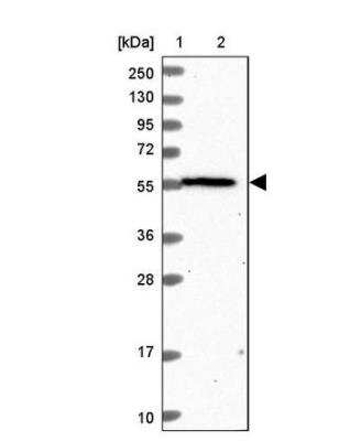 Western Blot: OSBPL2 Antibody [NBP1-92236]