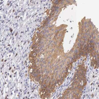 Immunohistochemistry-Paraffin: OSBPL3 Antibody [NBP1-82968]