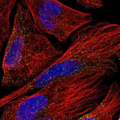 Immunocytochemistry/ Immunofluorescence: OSBPL5 Antibody [NBP1-81403]